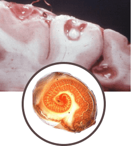 Parasite